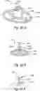 Fig. 20 - Devices, systems and methods for treating benign prostatic hyperplasia and other conditions