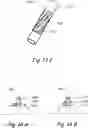 Fig. 22 - Devices, systems and methods for treating benign prostatic hyperplasia and other conditions