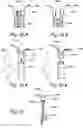 Fig. 27 - Devices, systems and methods for treating benign prostatic hyperplasia and other conditions