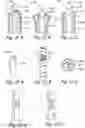 Fig. 28 - Devices, systems and methods for treating benign prostatic hyperplasia and other conditions