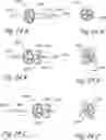 Fig. 32 - Devices, systems and methods for treating benign prostatic hyperplasia and other conditions