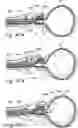 Fig. 44 - Devices, systems and methods for treating benign prostatic hyperplasia and other conditions