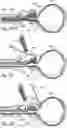 Fig. 45 - Devices, systems and methods for treating benign prostatic hyperplasia and other conditions