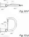 Fig. 47 - Devices, systems and methods for treating benign prostatic hyperplasia and other conditions