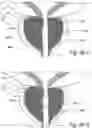 Fig. 50 - Devices, systems and methods for treating benign prostatic hyperplasia and other conditions