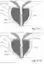 Fig. 53 - Devices, systems and methods for treating benign prostatic hyperplasia and other conditions