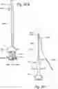 Fig. 59 - Devices, systems and methods for treating benign prostatic hyperplasia and other conditions