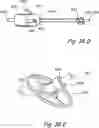 Fig. 60 - Devices, systems and methods for treating benign prostatic hyperplasia and other conditions
