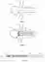 Fig. 02 - FLOW DIVERTER DELIVERY SYSTEMS AND ASSOCIATED METHODS