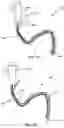 Fig. 10 - ELECTROSURGICAL APPARATUS AND METHOD