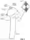 Fig. 06 - SURGICAL SYSTEMS, METHODS, AND DEVICES EMPLOYING AUGMENTED REALITY (AR) INSTRUMENT GUIDANCE