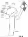 Fig. 07 - SURGICAL SYSTEMS, METHODS, AND DEVICES EMPLOYING AUGMENTED REALITY (AR) INSTRUMENT GUIDANCE