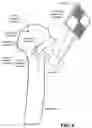 Fig. 09 - SURGICAL SYSTEMS, METHODS, AND DEVICES EMPLOYING AUGMENTED REALITY (AR) INSTRUMENT GUIDANCE