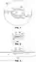 Fig. 06 - INTROCULAR LENS