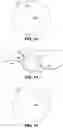 Fig. 08 - INTROCULAR LENS