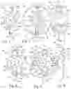 Fig. 02 - IMPLANTABLE ACCOMODATING INTRAOCULAR LENSES, IOL IMPLANTS, AND RELATED SYSTEMS AND METHODS