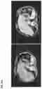 Fig. 09 - BIOMARKERS FOR NANOPARTICLE COMPOSITIONS