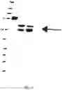Fig. 04 - WT1 VACCINE