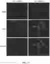 Fig. 11 - WT1 VACCINE