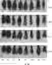 Fig. 06 - COMPOSITIONS AND METHODS FOR ELONGATING CURLY HAIR