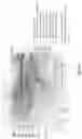 Fig. 09 - COMPOSITIONS AND METHODS OF CHIMERIC AUTOANTIBODY RECEPTOR T CELLS