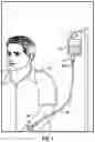 Fig. 02 - Tubing junction assembly