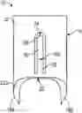 Fig. 01 - TISSUE ANCHORS FOR ENDOSCOPICALLY CLOSING GASTROINTESTINAL DEFECTS