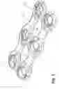 Fig. 02 - Resiliant Spinal Plate System