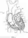 Fig. 02 - Tissue anchor deployment