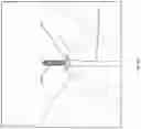 Fig. 29 - Tissue anchor deployment