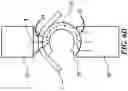 Fig. 16 - Contoured Electrodes for Joining Workpieces with Curved Surfaces