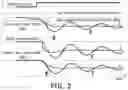 Fig. 03 - Vehicle turning control device and method thereof
