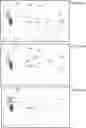 Fig. 12 - VISION CORRECTION SYSTEM AND METHOD, LIGHT FIELD DISPLAY AND LIGHT FIELD SHAPING LAYER AND ALIGNMENT THEREFOR