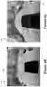 Fig. 07 - IMAGE STITCHING WITH AN ADAPTIVE THREE-DIMENSIONAL BOWL MODEL OF THE SURROUNDING ENVIRONMENT FOR SURROUND VIEW VISUALIZATION