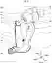 Fig. 03 - MEDICAL EXAMINATION DEVICE