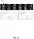 Fig. 05 - Method and Device for Magnetic Resonance Imaging Pre-Scan, and Magnetic Resonance Imaging System