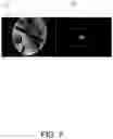 Fig. 07 - Method and Device for Magnetic Resonance Imaging Pre-Scan, and Magnetic Resonance Imaging System