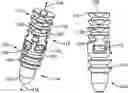 Fig. 01 - PUSH-IN SUTURE ANCHOR SYSTEM