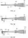 Fig. 07 - PUSH-IN SUTURE ANCHOR SYSTEM