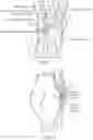 Fig. 02 - Method and Apparatus For Force Redistribution in Articular Joints