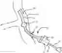 Fig. 01 - EXPANDABLE INTRODUCER SHEATH