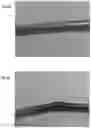 Fig. 06 - EXPANDABLE INTRODUCER SHEATH
