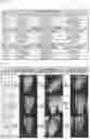 Fig. 02 - METHOD FOR PREPARING INJECTABLE INJECTION COMPOSITION DERIVED FROM ANIMAL CARTILAGE, AND USE THEREOF