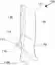 Fig. 01 - Visor clip and sun visor assembly equipped with visor clip