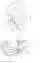Fig. 10 - INTERVENTRICULAR SEPTUM PROTECTION