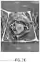 Fig. 06 - WEARABLE THERAPY DEVICE FOR PROVIDING TEMPERATURE AND COMPRESSION THERAPY