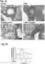 Fig. 07 - BOYSENBERRY COMPOSITIONS AND METHODS OF PREPARATION AND USE THEREOF