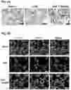 Fig. 09 - BOYSENBERRY COMPOSITIONS AND METHODS OF PREPARATION AND USE THEREOF