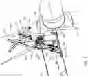Fig. 02 - LIFTING SYSTEM FOR A ROTOR BLADE OF A WIND TURBINE