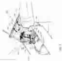 Fig. 04 - LIFTING SYSTEM FOR A ROTOR BLADE OF A WIND TURBINE